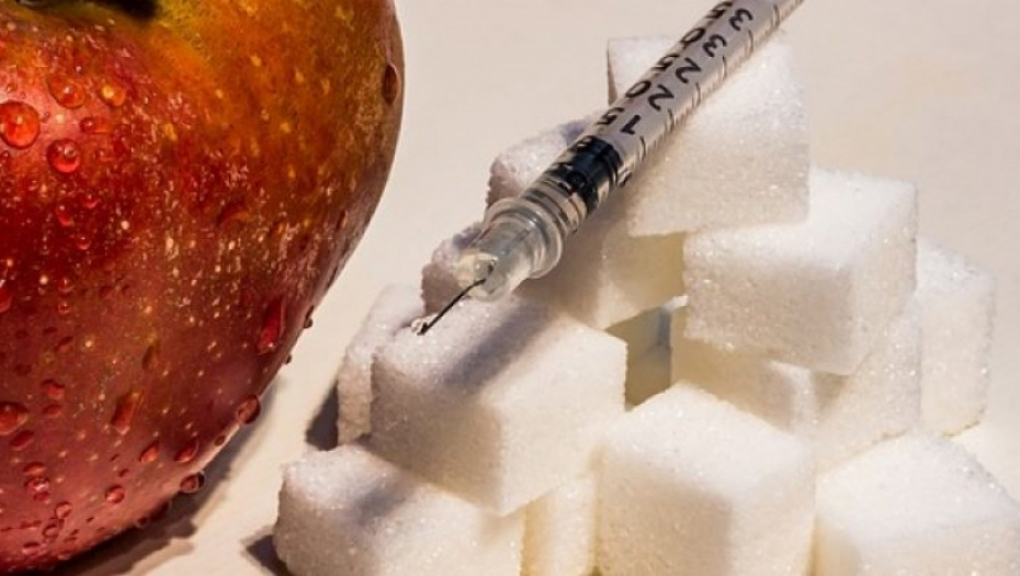 IMATE PROMENE NA KOŽI VRATA, RAMENA, HITNO KOD LEKARA! Ovo mogu biti rani simptomi šećerne bolesti