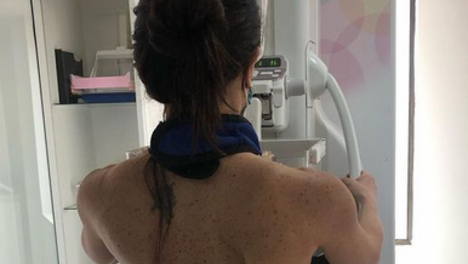 KASANDRA ZAPOČELA BORBU PROTIV KARCINOMA I OTKRILA REZULTATE "Bila sam na mamografiji i ultrazvučnom pregledu"