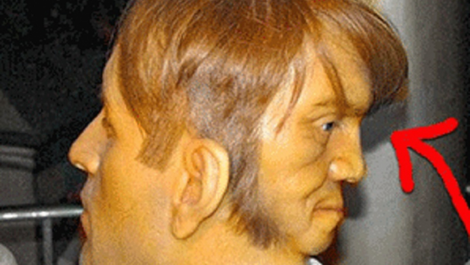 Priča o čoveku kojeg "demonsko" drugo lice na potiljku tera na samoubistvo nije ono što mislite da jeste