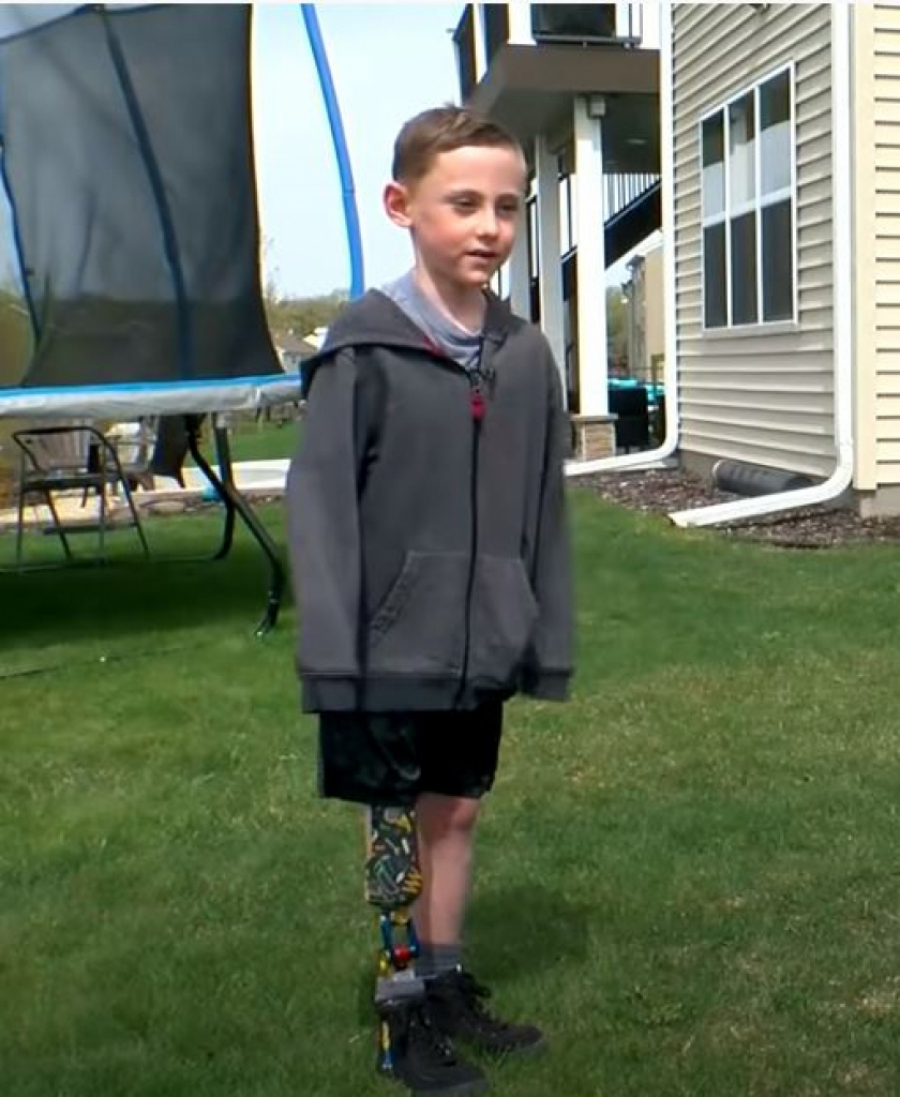 Štene bez šape zauvek  je pronašao dom kod dečaka koji se nalazi u sličnoj situaciji (VIDEO)