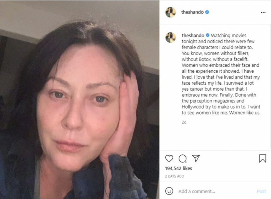 RAK NE JENJAVA Poznata glumica vodi svoju životnu bitku, strašna bolest uzela je maha, evo kako sada izgleda! (FOTO)