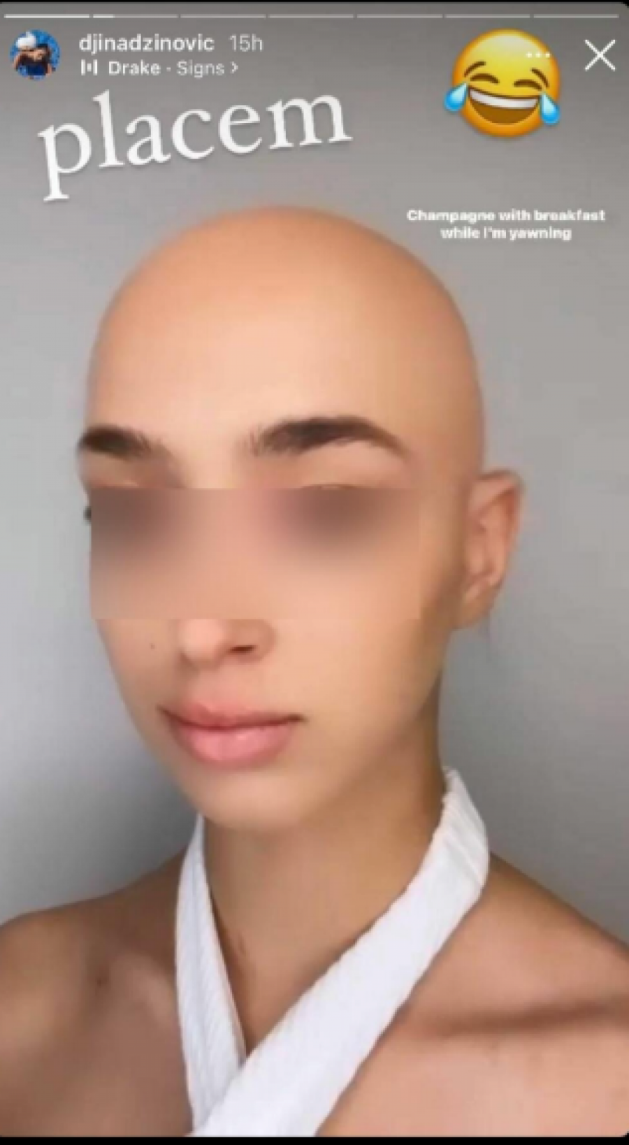 ĆERKA HARISA DŽINOVIĆA ĆELAVA Đina objavila fotografiju bez ijedne dlake na glavi i šokirala javnost (FOTO)