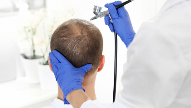 "POČINJEM DA ĆELAVIM!" Pacijenti koji su preležali Kovid-19 sve češće sa žale na ovaj problem!