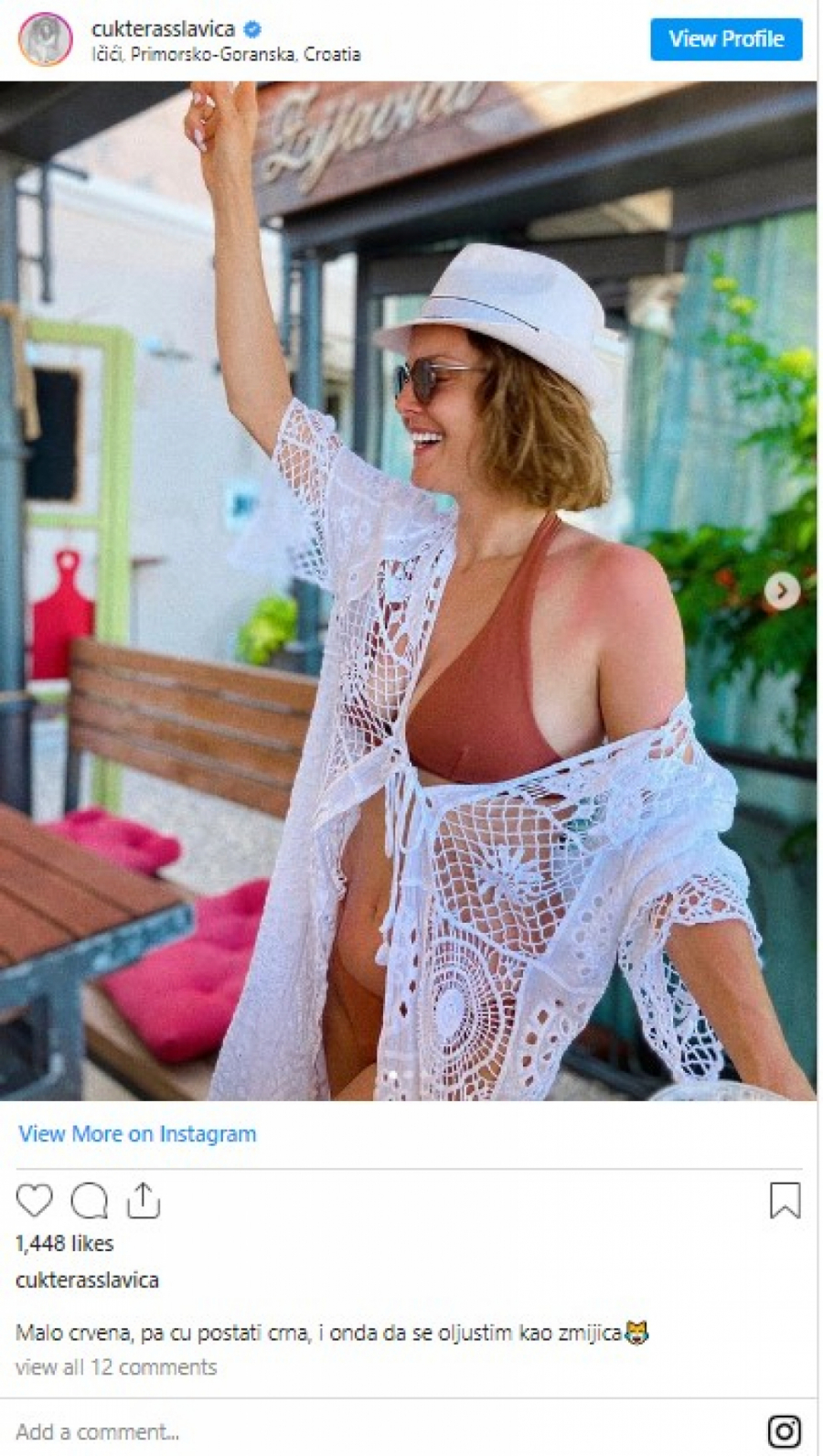 PRETERALA SA SUNČANJEM Slavica Ćukteraš objavila fotku sa opekotinama na intimnim mestima i apelovala na druge da se paze (FOTO)