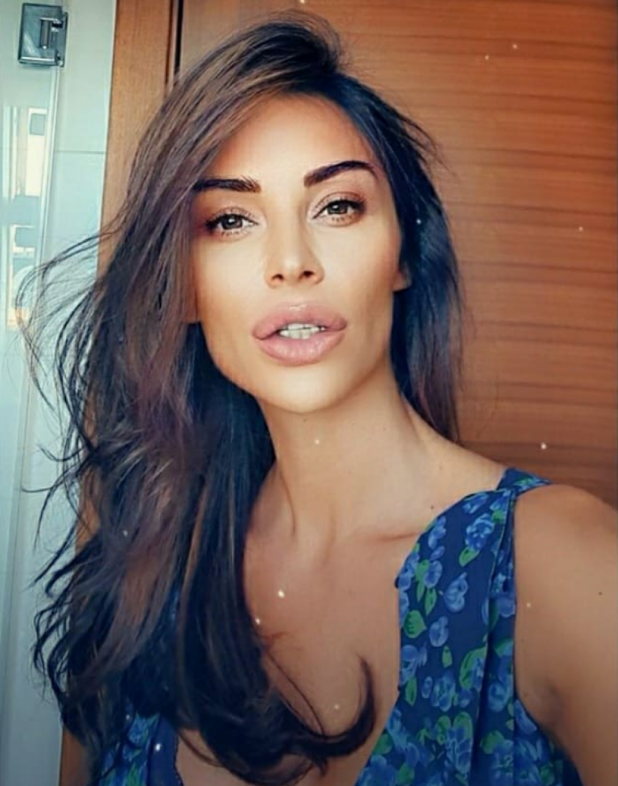 BOLJE DA SU MI BUBREG NAŽIVO VADILI Ovo su poznate dame koje su se jedva rešile silikona u usnama, evo kako sada izgledaju!