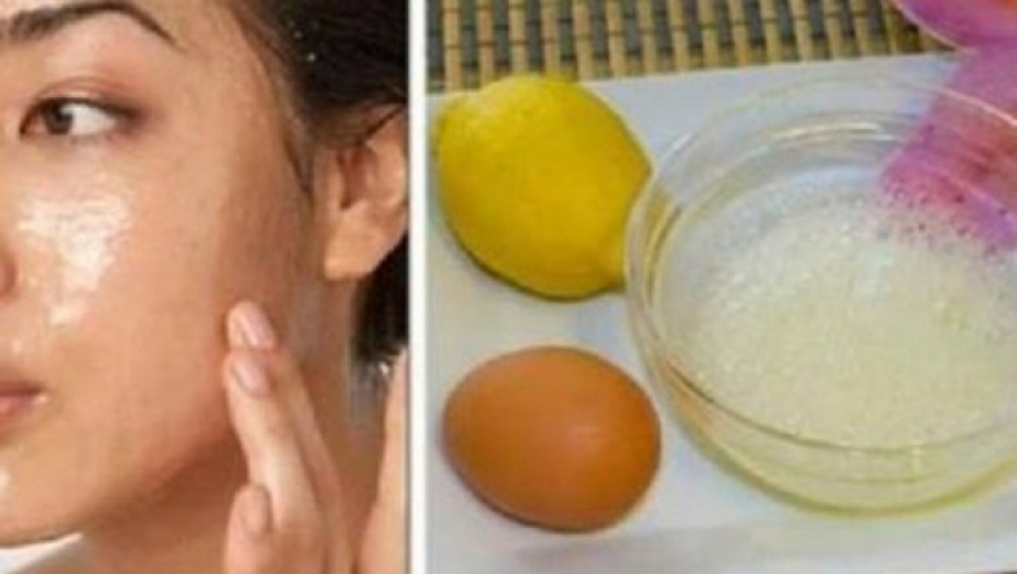 NISU VAM POTREBNI SKUPI TRETMANI: Napravila masku za lice od 2 sastojka, pa iznenadila doktore, podmladila se nekoliko godina