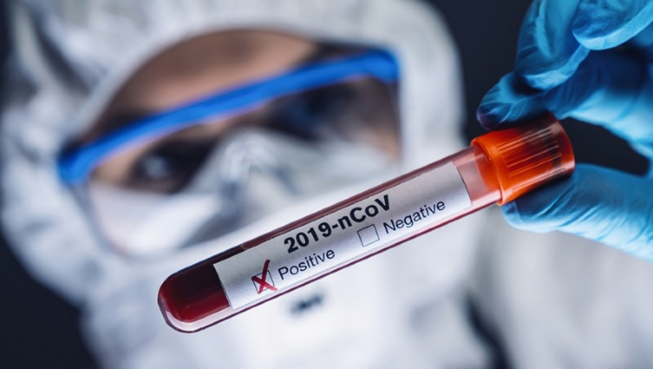 DA BI SE IZVUKAO, POSLAO BRATA DA URADI TEST OČINSTVA! Ono što je saznao može ga odvesti u zatvor