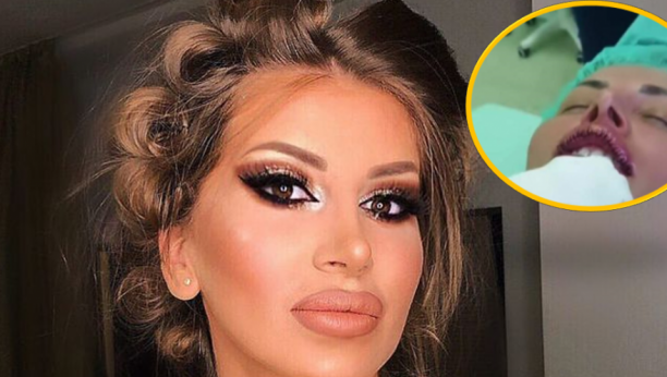 MISLILA SAM DA ĆU DA UMREM, NAJPRE SAM NAPIPALA KUGLICU Dalila prošla kroz pakao zbog silikona u usnama! (UZNEMIRIJUĆE FOTOGRAFIJE)