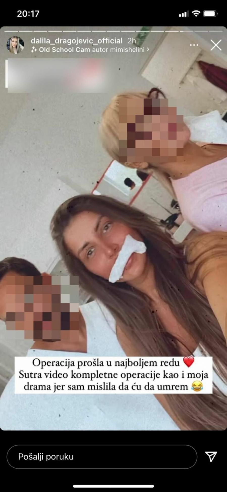 MISLILA SAM DA ĆU DA UMREM, NAJPRE SAM NAPIPALA KUGLICU Dalila prošla kroz pakao zbog silikona u usnama! (UZNEMIRIJUĆE FOTOGRAFIJE)