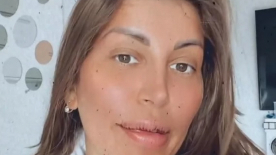 Dalila Dragojević pre operacija