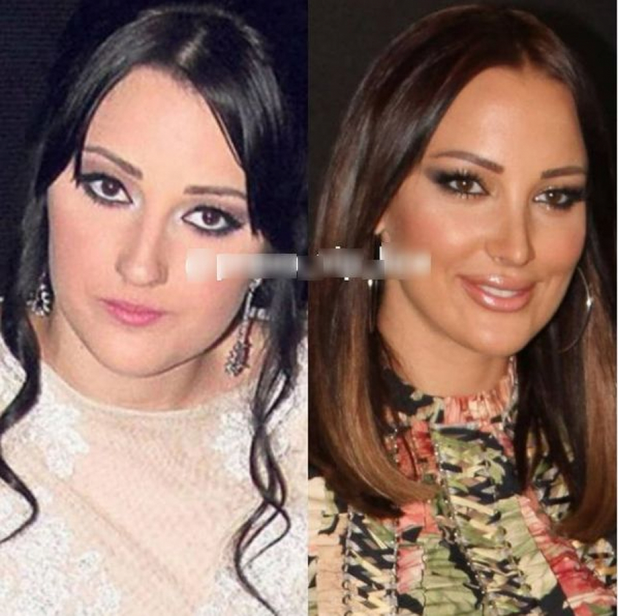 EVO KAKO JE ALEKSANDRA PRIJOVIĆ IZGLEDALA PRE ESTETSKIH ZAHVATA! Isplivale šok fotografije, ne liči na sebe!