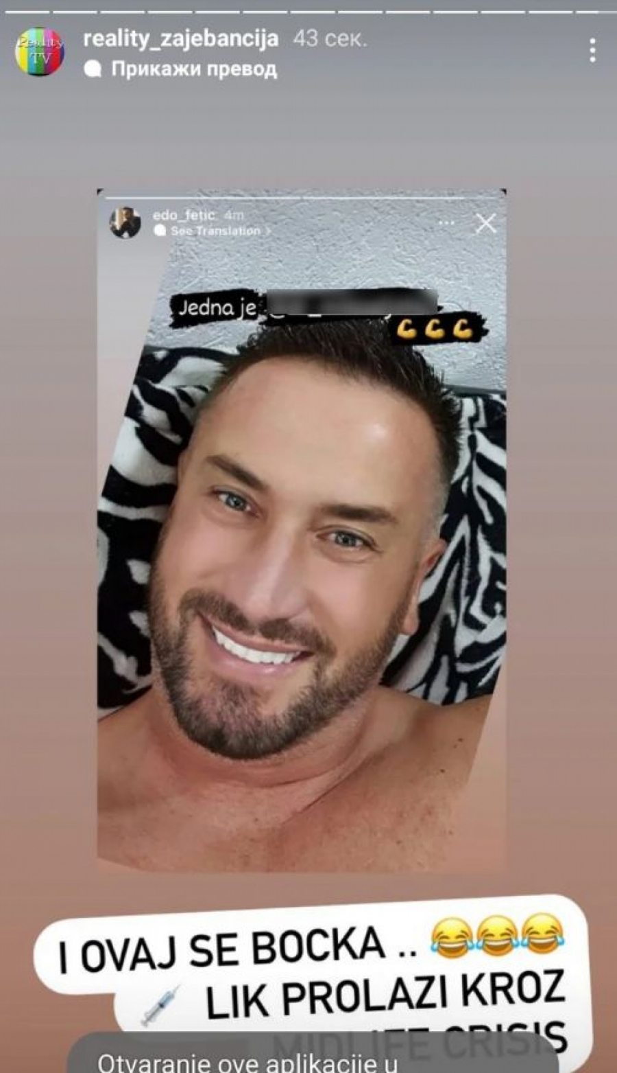 EDIS OTIŠAO POD NOŽ! Bivši zadrugar objavio fotografiju i izazvao lavinu negativnih komentara, svi se pitaju zbog čega je to uradio na sebi (FOTO)