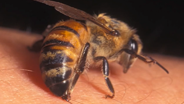 MOŽE DA BUDE VRLO BOLAN: Šta da radite u slučaju uboda pčele?