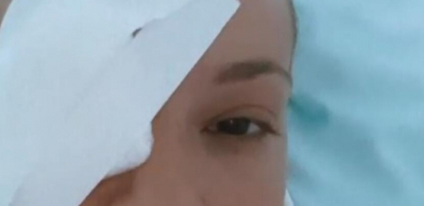 OTKRIVENO ČIME JE SLAVICA ĆUKTERAŠ UMALO IZBILA OKO Pevačici se iskomplikovala povreda, zadržali je na lečenju!