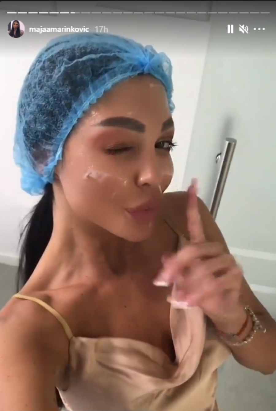 MAJA MARINKOVIĆ NA OPERACIJI LICA! Zadrugarka objavila fotku iz bolnice, više neće izgledati isto!