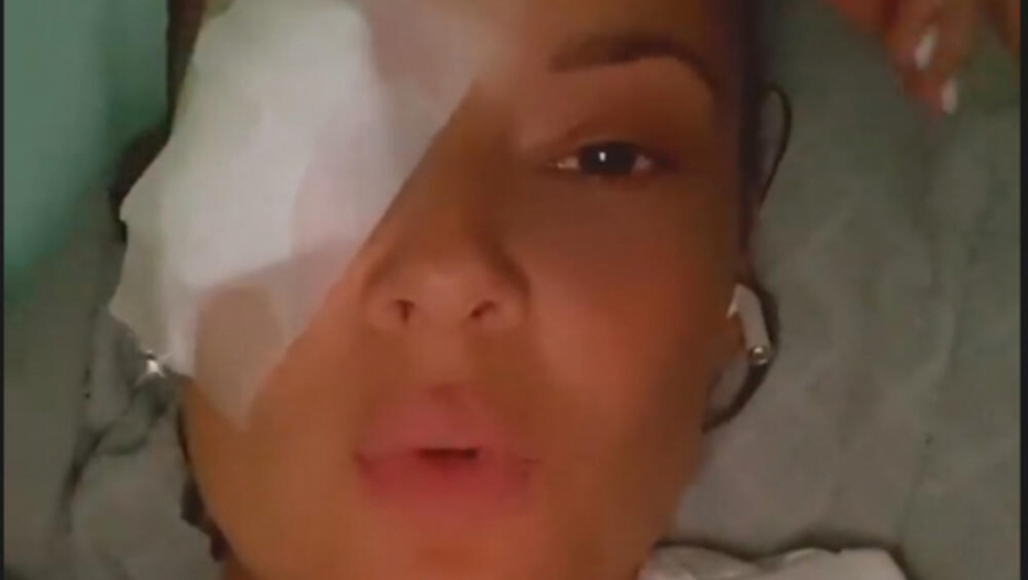 SVI SU SE PLAŠILI ZA NJEN VID Evo kako sada izgleda Slavica Ćukteraš! (FOTO)