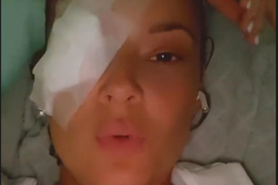 OTKRIVENO ČIME JE SLAVICA ĆUKTERAŠ UMALO IZBILA OKO Pevačici se iskomplikovala povreda, zadržali je na lečenju!