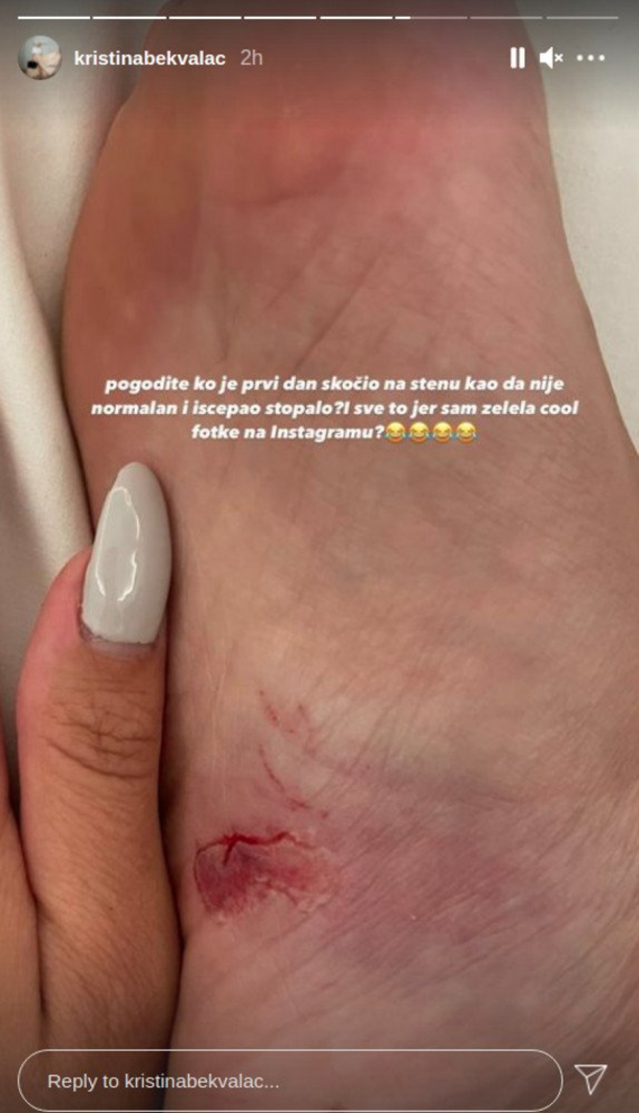 BEKVALČEVA POCEPALA STOPALO Pala na stenu i zadobila ozbiljnu povredu u Crnoj Gori