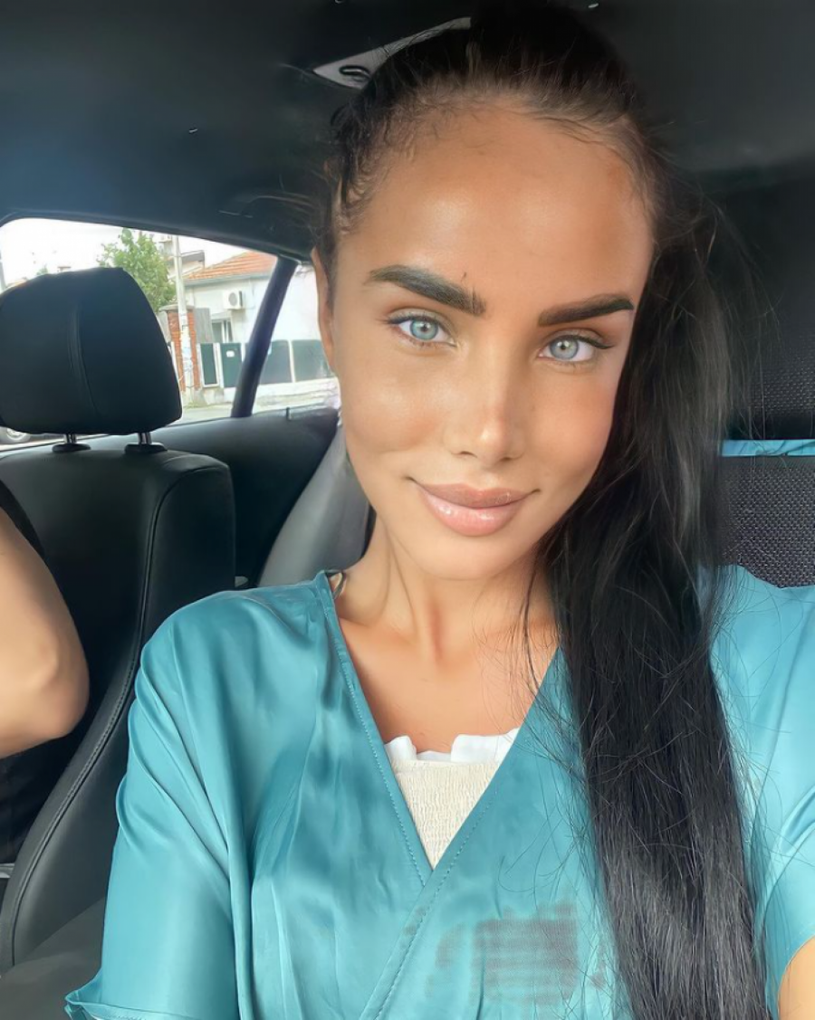 URADILA JOŠ JEDAN ESTETSKI ZAHVAT NA LICU! Aleksandra Subotić šokirala pratioce novim izgledom, a evo šta je promenila!