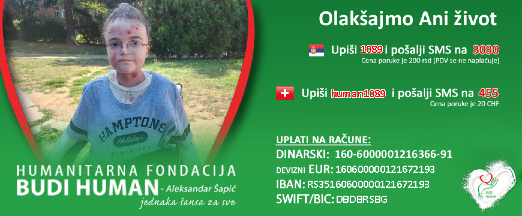 Anu boli svaki dodir, ali naša pomoć ublažiće njene muke: Pomažu samo specijalne gaze i stalna nega