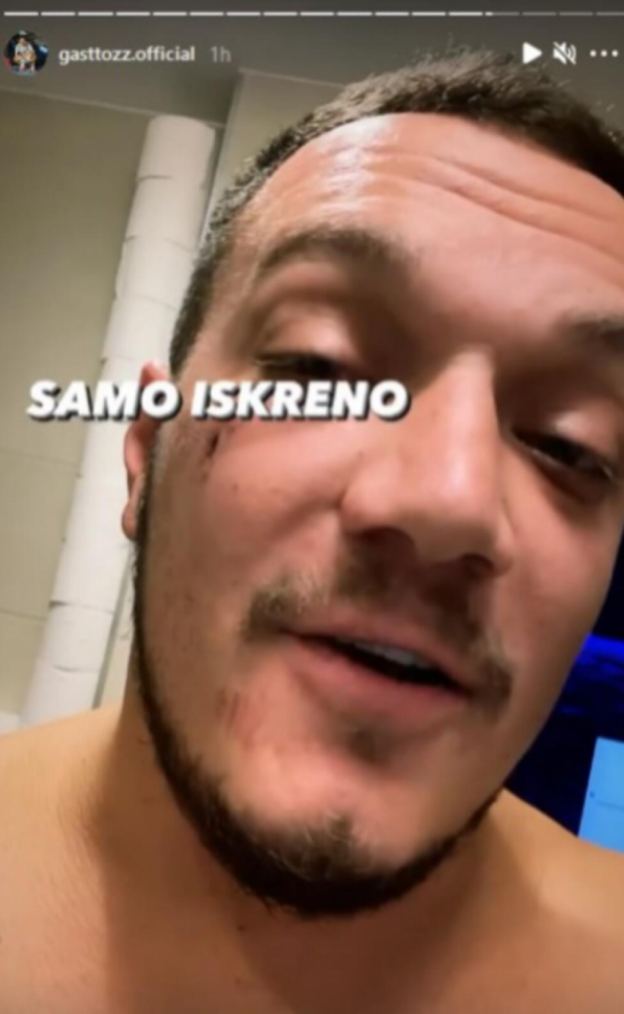 GASTOZ PRETUČEN?! Rijaliti zvezda objavila stravične povrede lice, fanovi u neverici (FOTO)