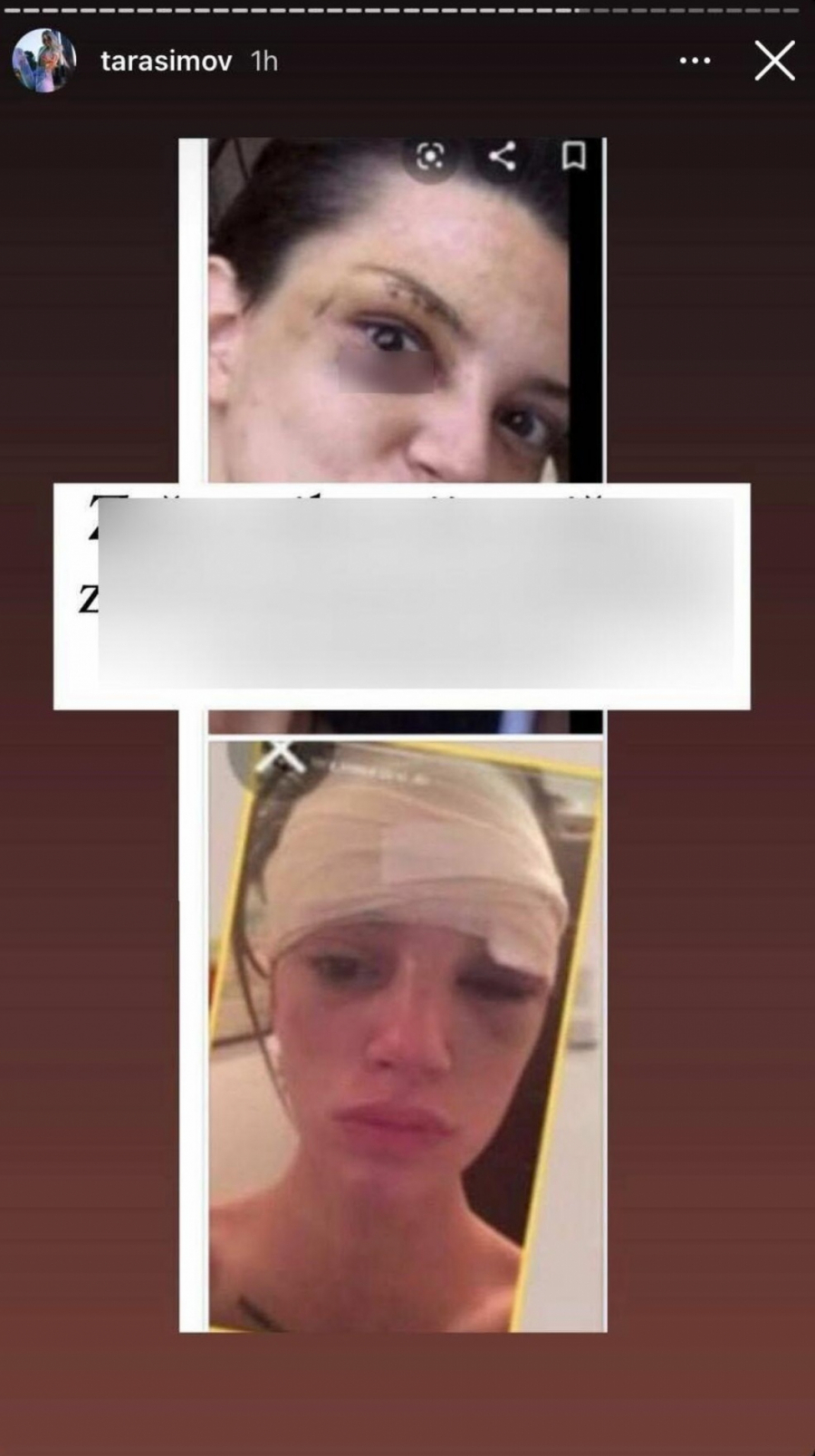 ANĐELA SE JAVNO IZVINILA TARI ZA KRVAVE BATINE Evo šta je Veštica rekla Simovoj, a ovako ju je unakazila