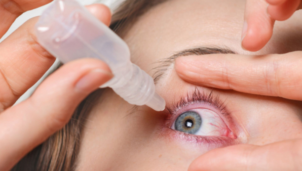 Svrab, crvenilo, nelagodnost u očnim kapcima: Evo kako da se otarasite čmička na oku