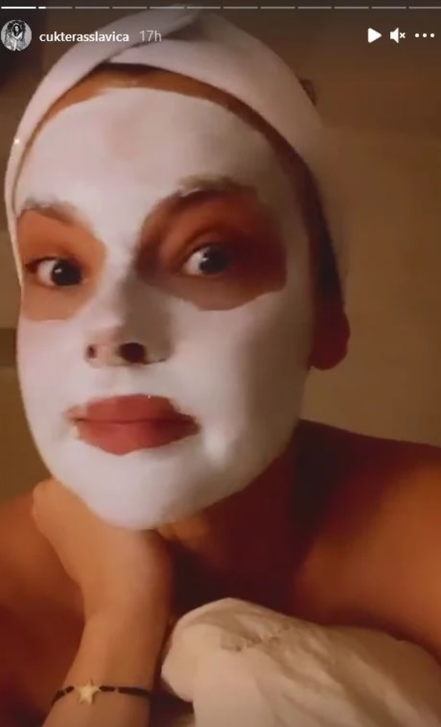 SVI SU SE PLAŠILI ZA NJEN VID Evo kako sada izgleda Slavica Ćukteraš! (FOTO)