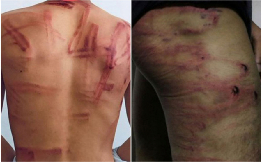 (UZNEMIRUJUĆE FOTOGRAFIJE) BRUTALNO MUČENJE NOVINARA Talibani unakazili nesrećne ljude!