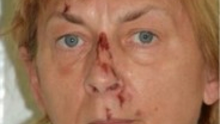 ŠOKANTAN OBRT SUDBINE: Zagonetna žena pronađena na morskim stenama krije strašnu misteriju