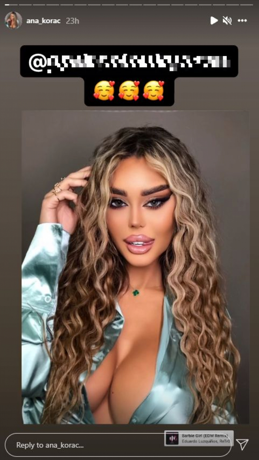 ANA KORAĆ EKSKLUZIVNO ZA ALO! Starleta konačno progovorila o silikonima, a onda obelodanila i sve o sponzoru koji joj kupuje skupocene poklone!