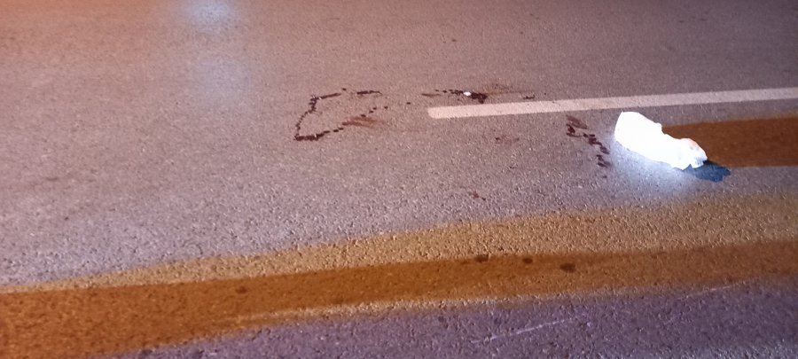 LEŽAO NA ZEMLJI OBLIVEN KRVLJU Mladić umalo da strada ispred kuće u Kikindi