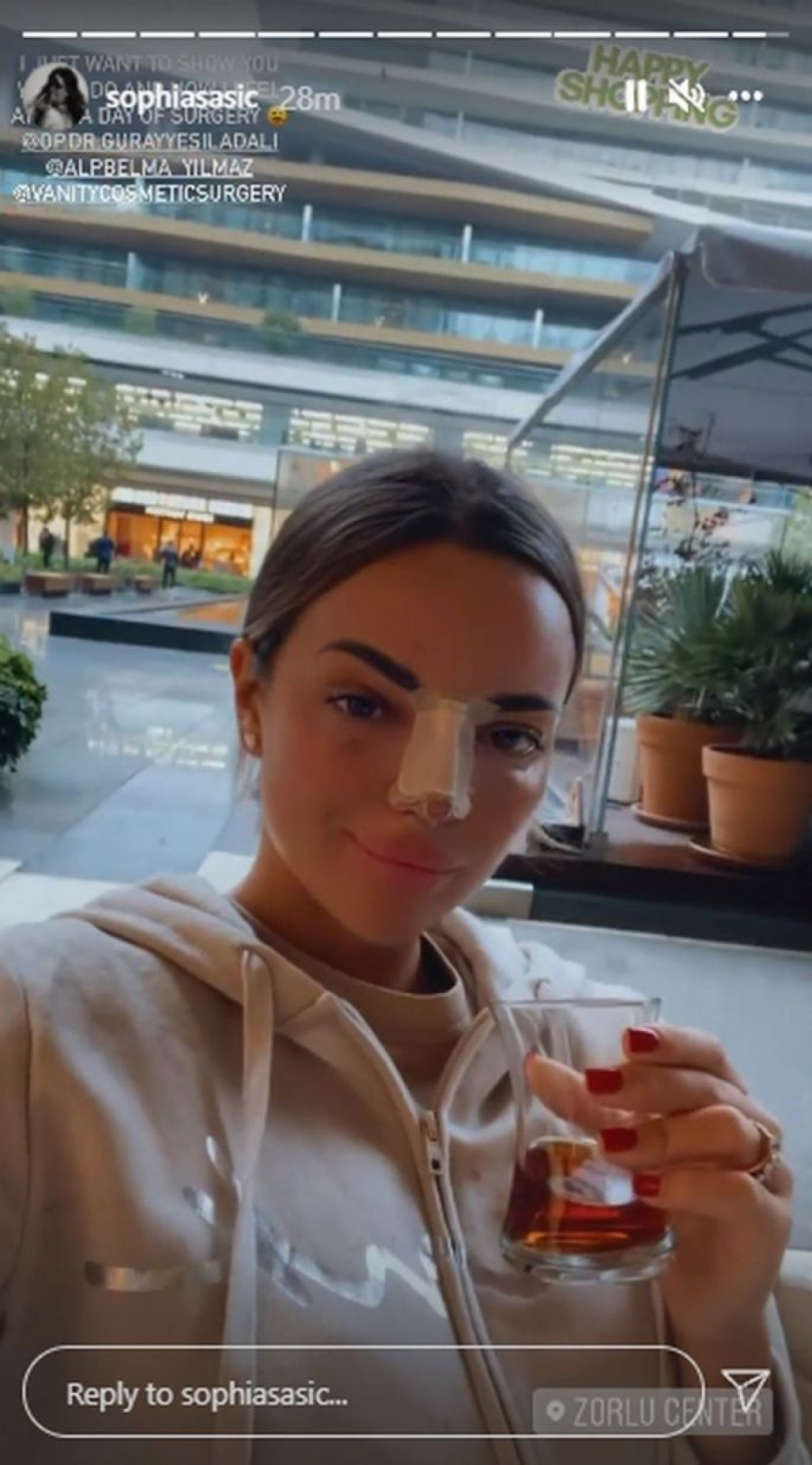 SOFIJA ŠAŠIĆ SE SNIMALA NAKON OPERACIJE NOSA Ovako sada izgleda, promena je baš vidljiva!