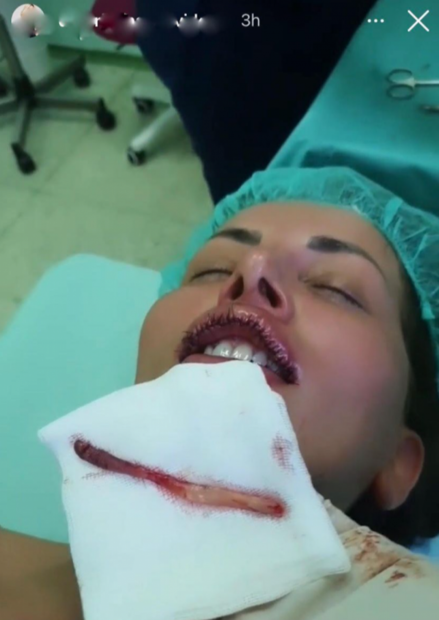 POTPUNO DRUGA OSOBA Dalila Dragojević posle estetskih zahvata ne liči na sebe, evo kako je izgledala pre rijaliti karijere!