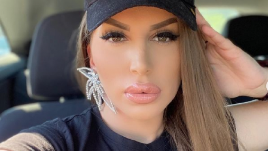 POTPUNO DRUGA OSOBA Dalila Dragojević posle estetskih zahvata ne liči na sebe, evo kako je izgledala pre rijaliti karijere!