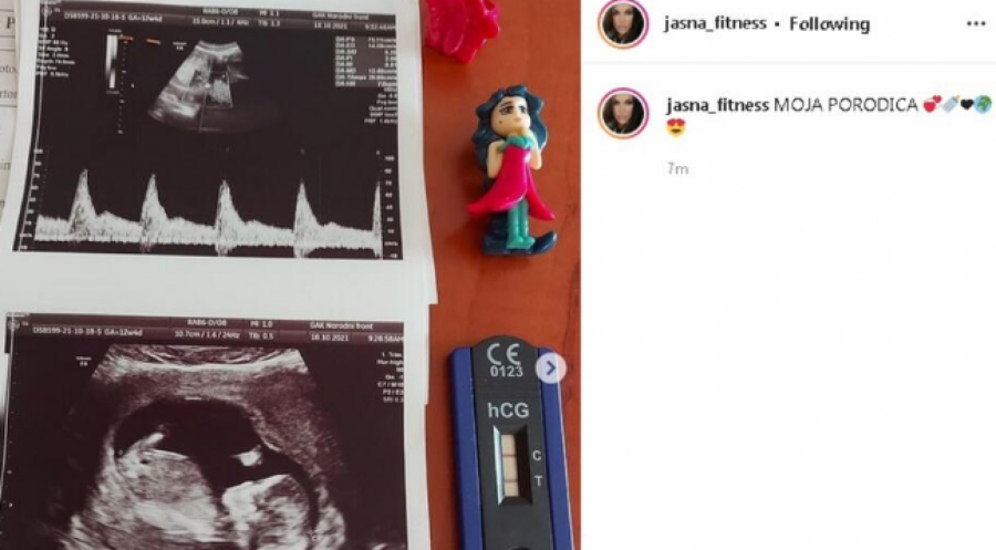 UČESNICA RIJALITIJA TRUDNA! Gastoz poručio: Ne brinite! Ja je čuvam!