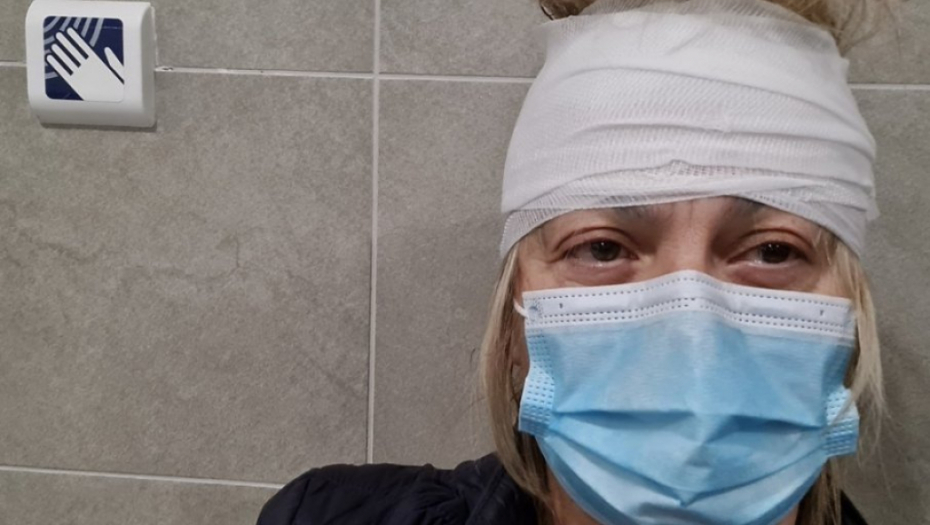 SA ZAVOJEM NA GLAVI Zamenica gradonačelnika Gline se oglasila nakon što joj je crep pao na teme