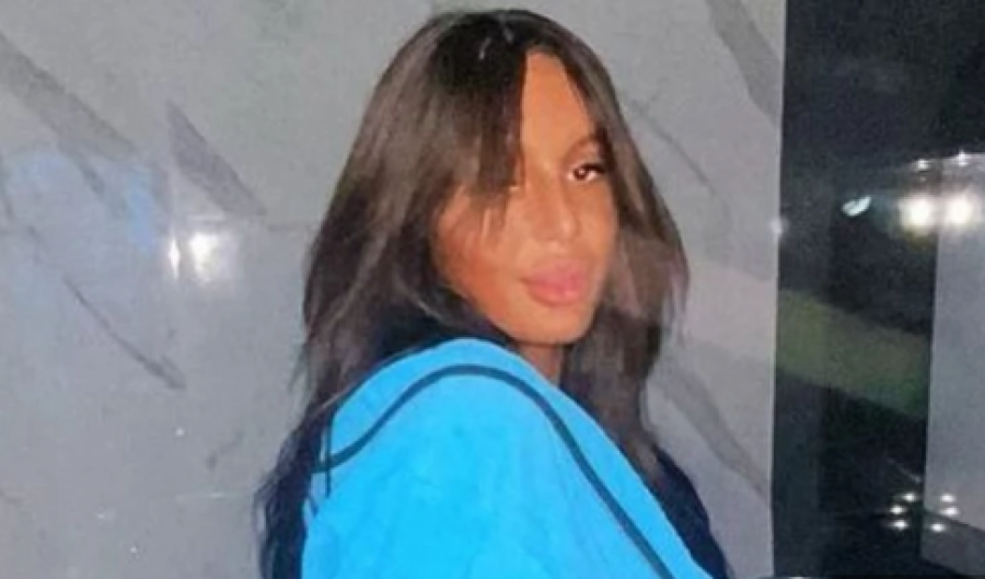 NINU ĐOGANI OPTUŽILI DA IZBELJUJE KOŽU Lunina sestra trpi stravične napade!