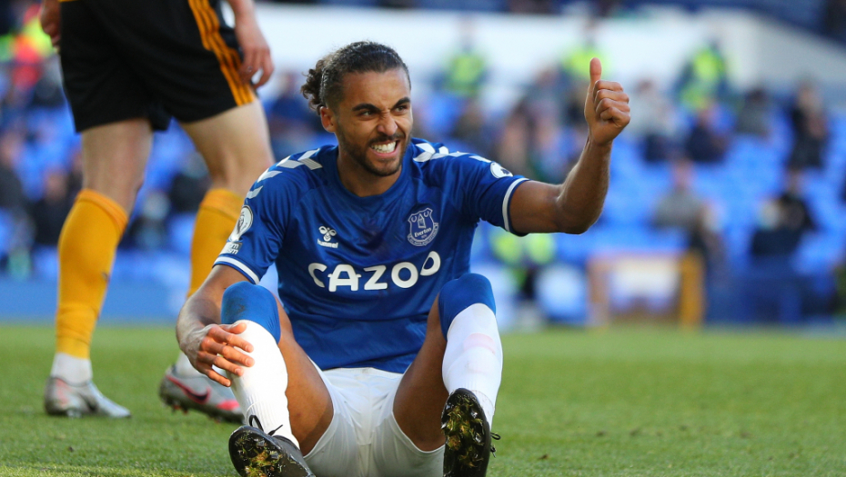 VELIKI UDARAC ZA EVERTON Napadač "karamela" slomio jagodičnu kost