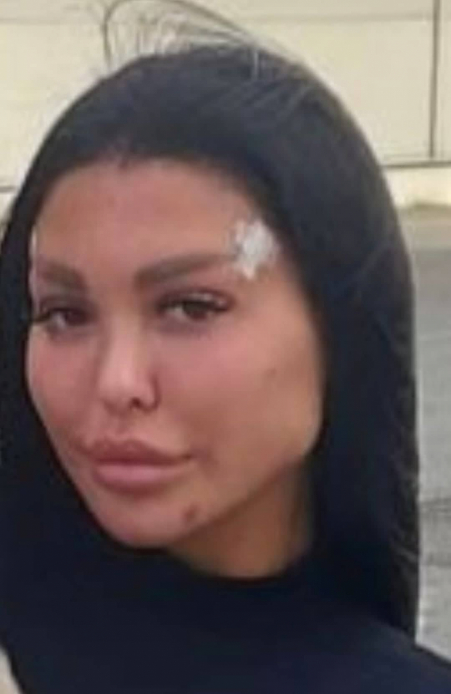 ULAZI SA FLASTERIMA NA LICU?! Maja Marinković uradila remont u poslednjem momentu, zadrugarka opet išla pod nož!