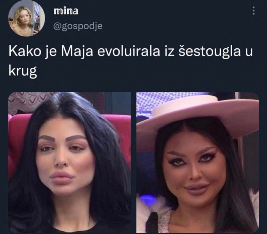 SVI JOJ SE SMEJU NA INTERNETU Maju Marinković zbog operacija urnišu: