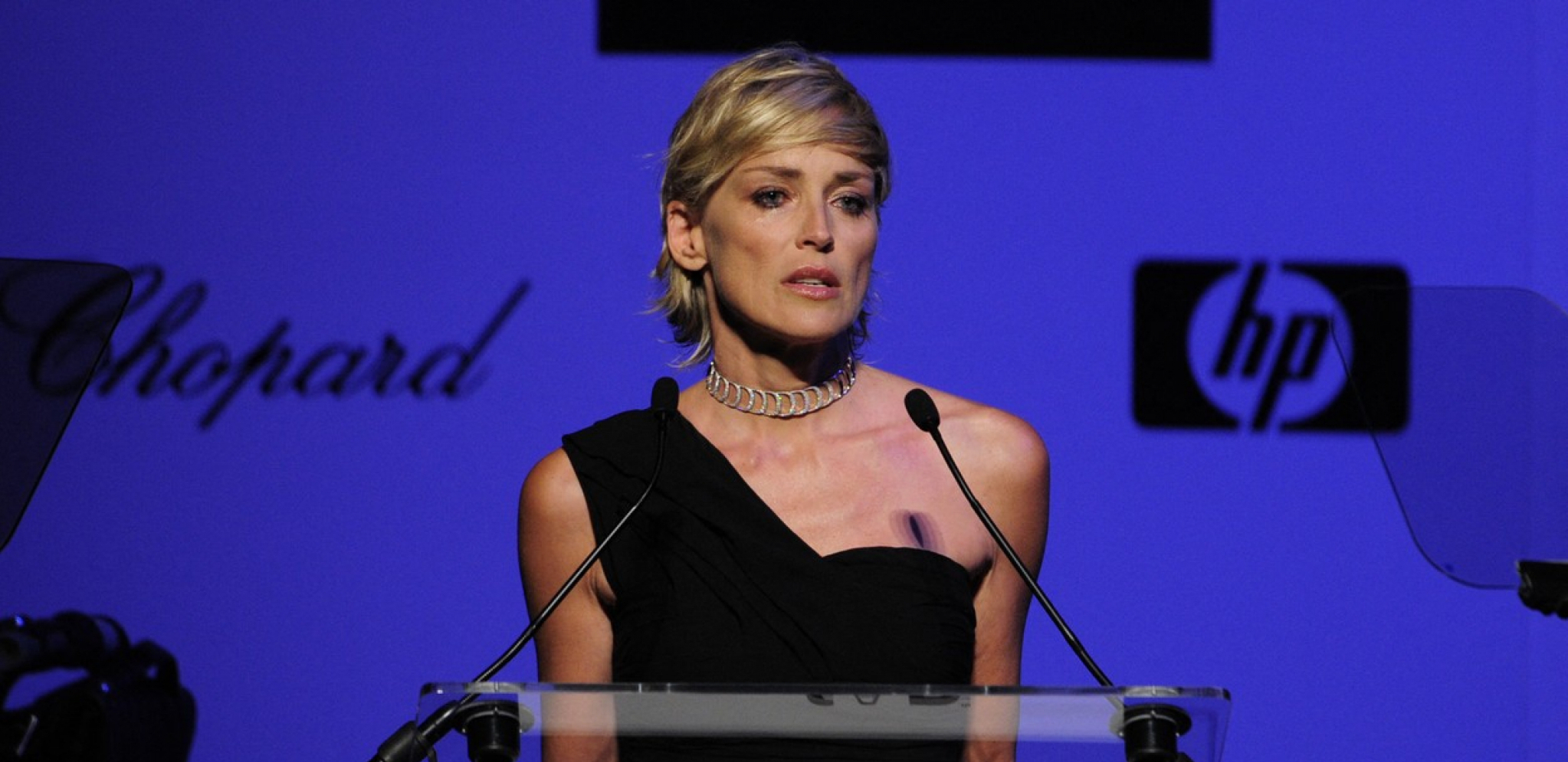 GLUMICA PROGOVORILA O ŠAMARANJU NA SNIMANJU Koleginica ju je udarila, izvinila se, a onda su usledila još dva šamara