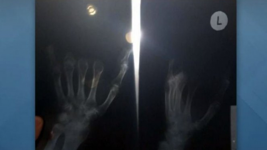 ŠOKANTNA ISPOVEST RADNICE MESARE IZ PANČEVA 