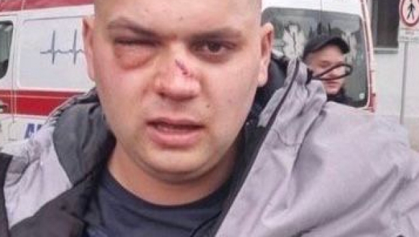 Žuti batinaši unakazili čoveka jer je hteo slobodno da se kreće u svojoj Srbiji! (FOTO)