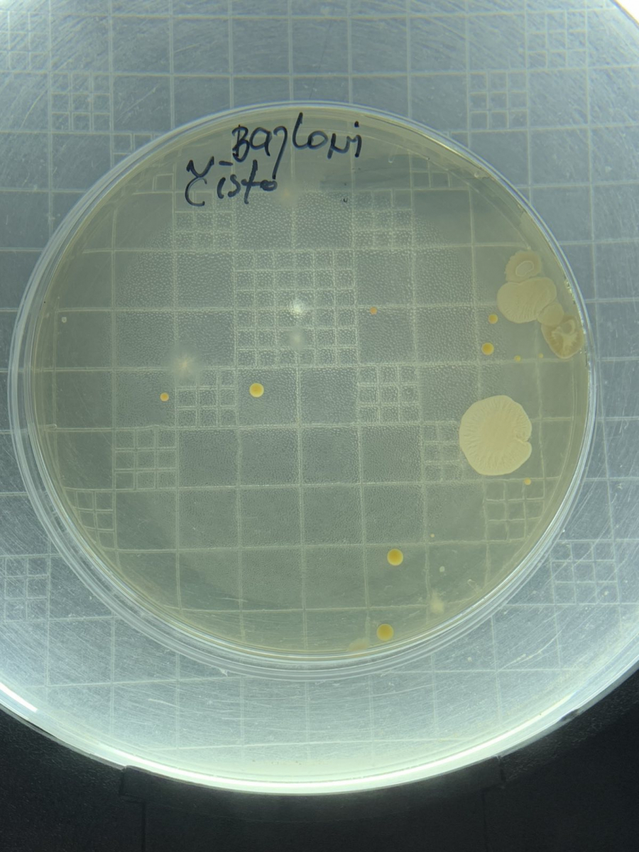Kuhinjski sunđer prljaviji od kontejnera