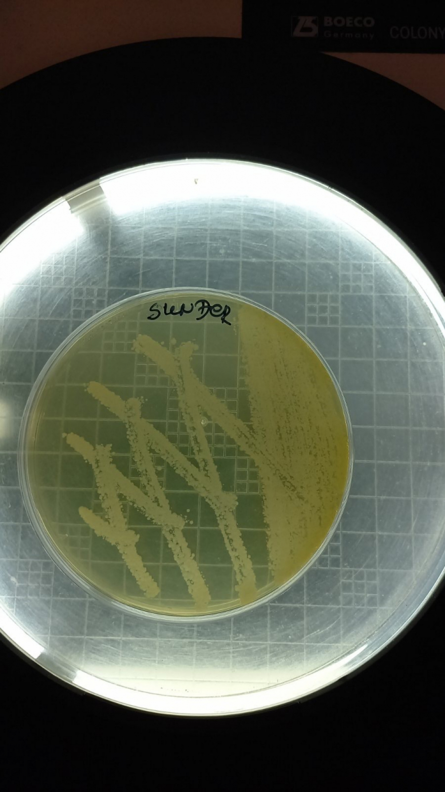 Kuhinjski sunđer prljaviji od kontejnera