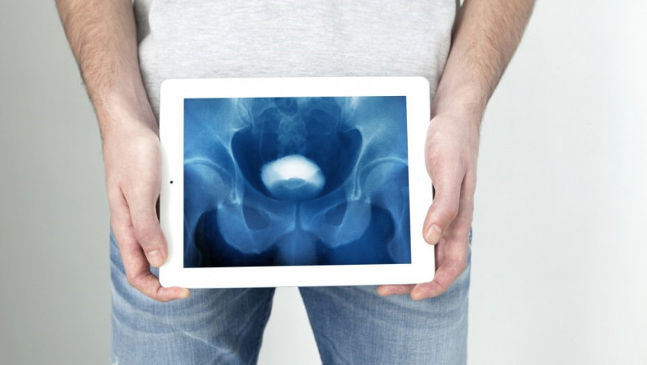 Laserska hirurgija – pravi izbor za muškarca s uvećanom prostatom: NAJSAVREMENIJE LEČENJE OD SADA I U SRBIJI