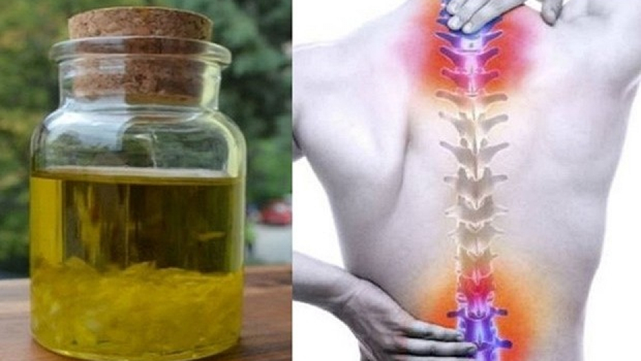 ZAUVEK SE OSLOBITITE BOLA Rešite probleme sa kičmom uz ovaj neverovatan ruski lek