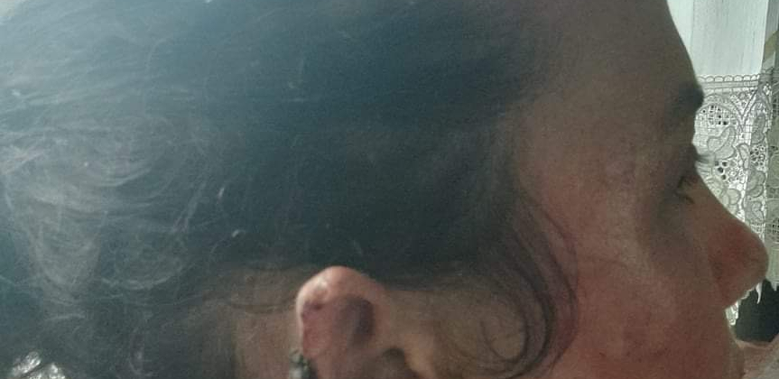 Slučaj koji je zgrozio Srbiju: Podignuta optužnica protiv nasilnika iz Zablaća koji je motkom pretukao majku četvoro dece