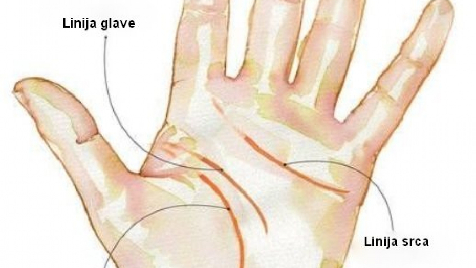 PROČITAJTE SA DLANA Ovaj znak otkriva kakvog ste zdravlja